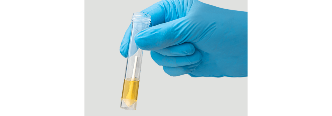 Complete Safety in Specimen Shipment Complete Safety in Specimen Shipment